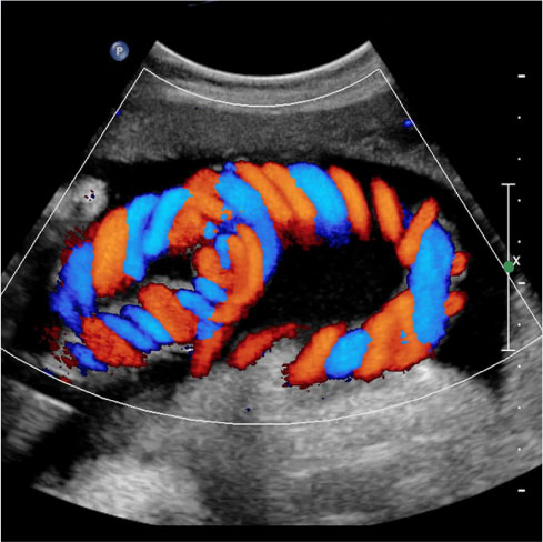 Best Color Doppler Test Centre In Navi Mumbai